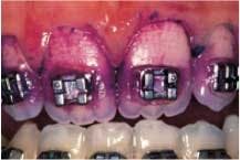 15janbfssimmonsgoodbadugly02 15janbfssimmonsgoodbadugly02