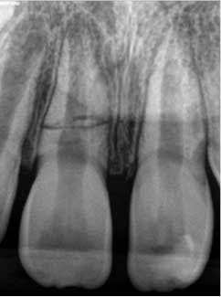 15june4bc Petrino02 15june4bc Petrino02