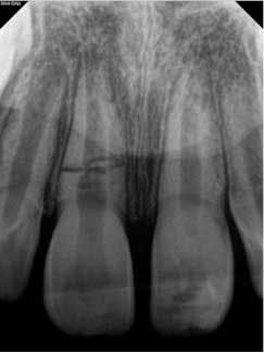 15june4bc Petrino03 15june4bc Petrino03