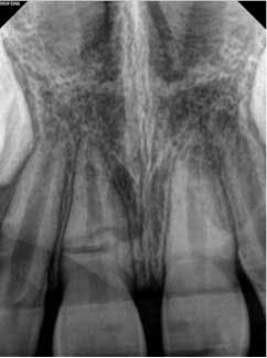 15june4bc Petrino04 15june4bc Petrino04