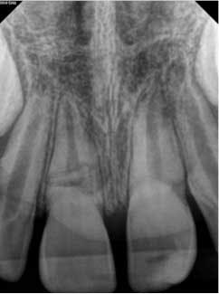 15june4bc Petrino05 15june4bc Petrino05