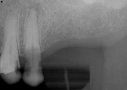 15june4bc Simmons Minixtrememakeover01 15june4bc Simmons Minixtrememakeover01