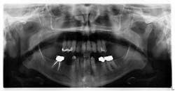 15june4bc Simmons Minixtrememakeover02 15june4bc Simmons Minixtrememakeover02