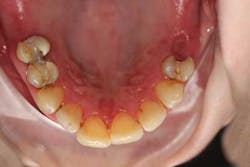 15june4bc Simmons Minixtrememakeover03 15june4bc Simmons Minixtrememakeover03