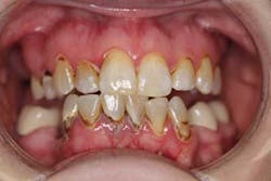 15june4bc Simmons Minixtrememakeover04 15june4bc Simmons Minixtrememakeover04