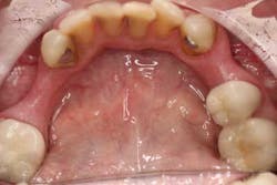 15june4bc Simmons Minixtrememakeover05 15june4bc Simmons Minixtrememakeover05