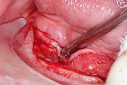 15june4bc Simmons Minixtrememakeover07 15june4bc Simmons Minixtrememakeover07