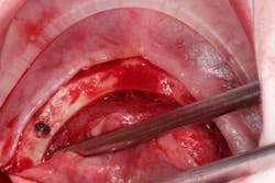 15june4bc Simmons Minixtrememakeover08 15june4bc Simmons Minixtrememakeover08