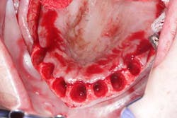 15june4bc Simmons Minixtrememakeover09 15june4bc Simmons Minixtrememakeover09