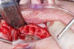 15june4bc Simmons Minixtrememakeover10 15june4bc Simmons Minixtrememakeover10