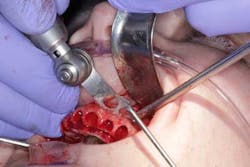 15june4bc Simmons Minixtrememakeover11 15june4bc Simmons Minixtrememakeover11