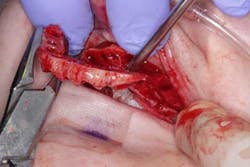 15june4bc Simmons Minixtrememakeover12 15june4bc Simmons Minixtrememakeover12