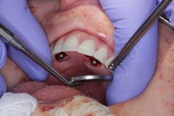 15june4bc Simmons Minixtrememakeover14 15june4bc Simmons Minixtrememakeover14