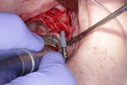 15june4bc Simmons Minixtrememakeover15 15june4bc Simmons Minixtrememakeover15