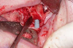 15june4bc Simmons Minixtrememakeover16 15june4bc Simmons Minixtrememakeover16