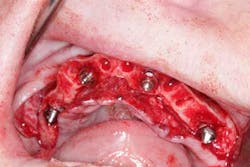 15june4bc Simmons Minixtrememakeover17 15june4bc Simmons Minixtrememakeover17