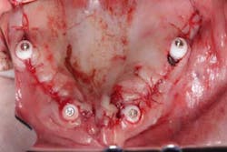 15june4bc Simmons Minixtrememakeover18 15june4bc Simmons Minixtrememakeover18