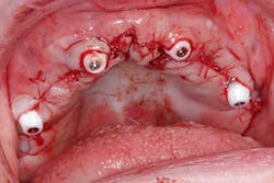 15june4bc Simmons Minixtrememakeover19 15june4bc Simmons Minixtrememakeover19