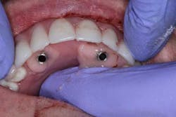 15june4bc Simmons Minixtrememakeover20 15june4bc Simmons Minixtrememakeover20