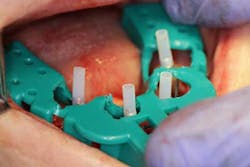 15june4bc Simmons Minixtrememakeover21 15june4bc Simmons Minixtrememakeover21