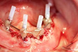 15june4bc Simmons Minixtrememakeover22 15june4bc Simmons Minixtrememakeover22