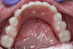 15june4bc Simmons Minixtrememakeover24 15june4bc Simmons Minixtrememakeover24