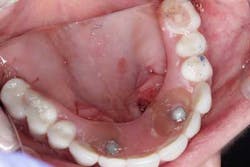 15june4bc Simmons Minixtrememakeover25 15june4bc Simmons Minixtrememakeover25