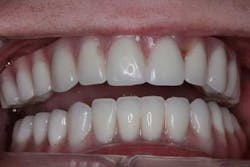 15june4bc Simmons Minixtrememakeover26 15june4bc Simmons Minixtrememakeover26