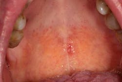 15may28srrfroum03 15may28srrfroum03