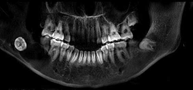15may7bc Pathology Case04 01rev