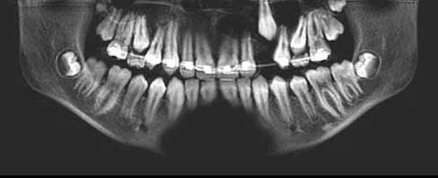 15may7bc Pathology Case04 02rev