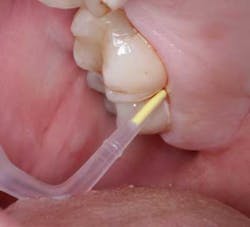 15may7bc Remien01 15may7bc Remien01