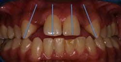 15may7bc Schmidt08 15may7bc Schmidt08