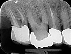 15may7bcmusikant Endoefficiency02 15may7bcmusikant Endoefficiency02
