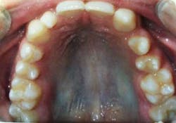 15sept3bc Andrews01 15sept3bc Andrews01