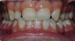 15sept3bc Andrews02 15sept3bc Andrews02