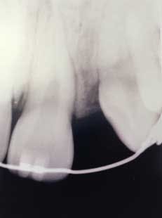 15sept3bc Andrews04 15sept3bc Andrews04