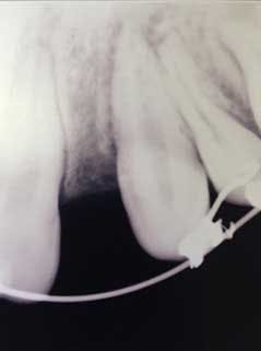 15sept3bc Andrews05 15sept3bc Andrews05