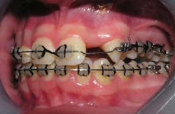 15sept3bc Andrews06 15sept3bc Andrews06