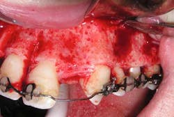 15sept3bc Andrews07 15sept3bc Andrews07