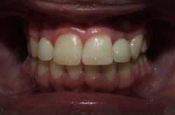 15sept3bc Andrews08 15sept3bc Andrews08