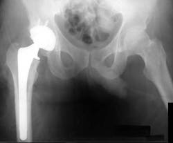 1 16 Focus 2 1 16 Focus 2