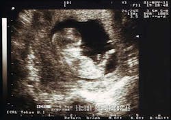 1 16 Focus 9 1 16 Focus 9