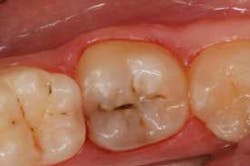 2014blank3mscotchbondselfetch01 2014blank3mscotchbondselfetch01