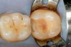 2014blank3mscotchbondselfetch02 2014blank3mscotchbondselfetch02