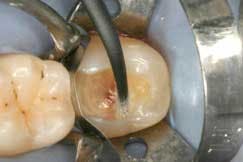 2014blank3mscotchbondselfetch03 2014blank3mscotchbondselfetch03