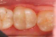 2014blank3mscotchbondselfetch05 2014blank3mscotchbondselfetch05