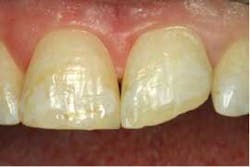 2014blank3mscotchbondtotaletch02 2014blank3mscotchbondtotaletch02