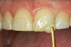 2014blank3mscotchbondtotaletch05 2014blank3mscotchbondtotaletch05