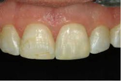 2014blank3mscotchbondtotaletch06 2014blank3mscotchbondtotaletch06